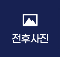 전후사진