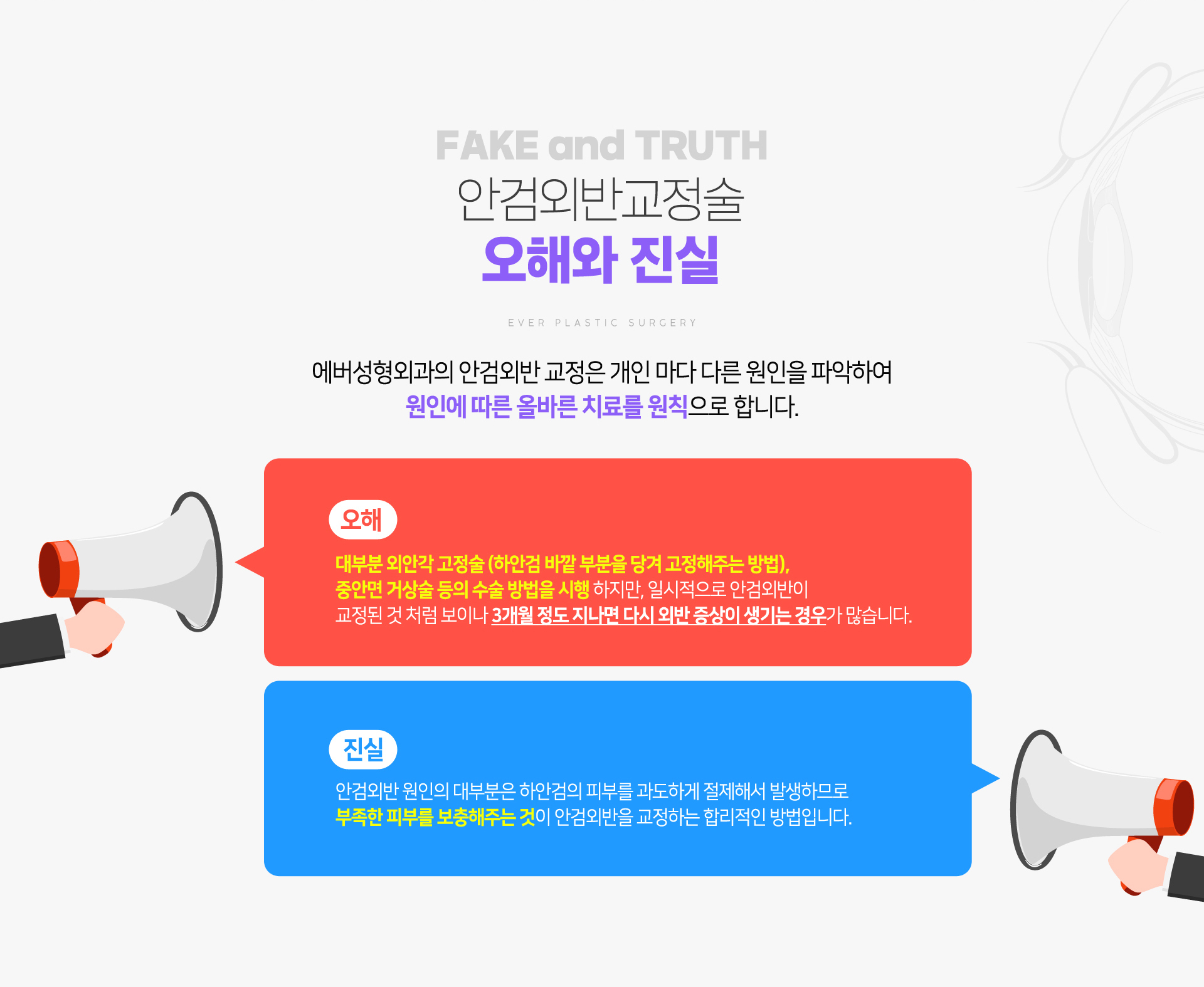 언검외반교정술 오해와 진실