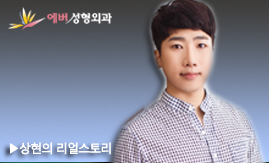 앞트임복원+쌍꺼풀(우)+코성형