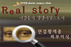 안검황색종 제거 + 피부이식