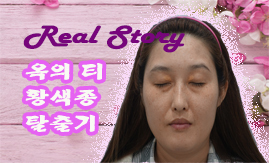 염**의 황색종 탈출기